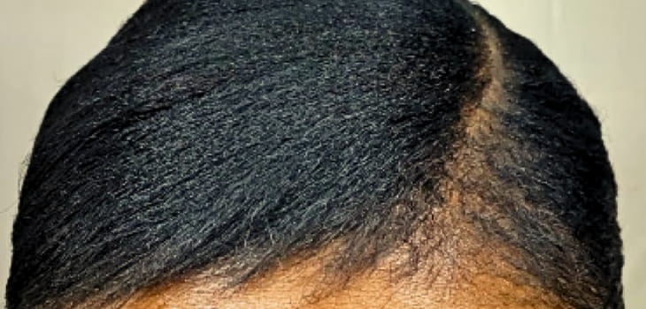 How to stop relaxed hair from breaking